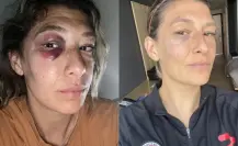 Jugadoras de la Liga MX Femenil denuncian falta de protección de árbitros
