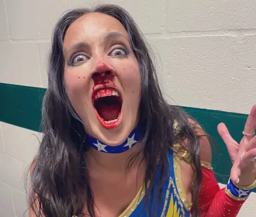 Chelsea Green terminó con la nariz rota tras su lucha con Zelina Vega en el WWE Saturday Nights Main Event. @ImChelseaGreen