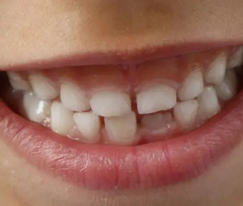 Hasta las plantas nativas te ayuda a conservar una bella sonrisa (Wikimedia Commons) Hasta las plantas nativas te ayuda a conservar una bella sonrisa (Wikimedia Commons)