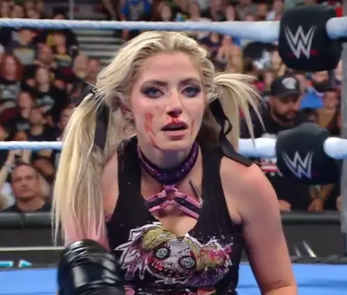 Alexa Bliss se habría roto la nariz en SmackDown, poniendo en riesgo su presencia en SummerSlam. @WWE Alexa Bliss se habría roto la nariz en SmackDown, poniendo en riesgo su presencia en SummerSlam. @WWE