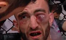 Mohammad Yahya termina con el ojo brutalmente dañado en UFC Abu Dhabi