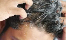 Profeco: Este shampoo es igual de bueno que Head & Shoulders, pero cuesta la mitad