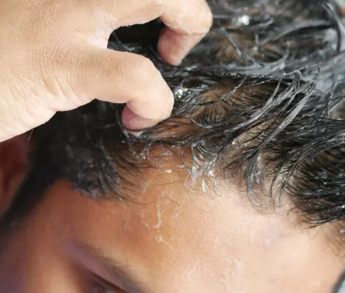 Profeco: Este shampoo es igual de bueno que Head & Shoulders, pero cuesta la mitad (Foto: Pexels)