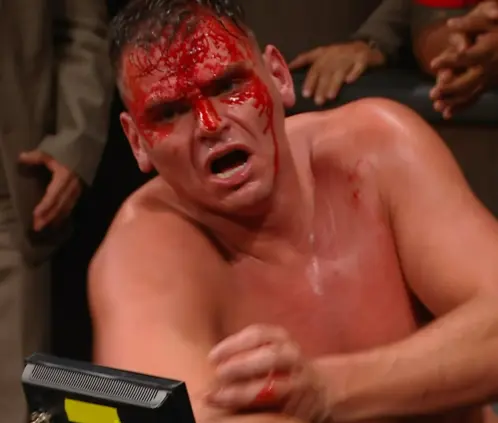 El SummerSlam 2025 marcó la última aparición de Gunther por un tiempo, al haber fracturado la nariz. @WWE El SummerSlam 2025 marcó la última aparición de Gunther por un tiempo, al haber fracturado la nariz. @WWE