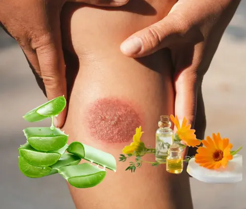 Aloe vera vs caléndula: descubre cuál es más eficaz para aliviar quemaduras o curar heridas (Getty Images)