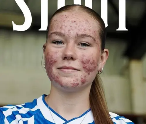 Skye Stout, futbolista de 16 años sufre acoso tras firmar contrato (OSCBCFC) Skye Stout, futbolista de 16 años sufre acoso tras firmar contrato (OSCBCFC)