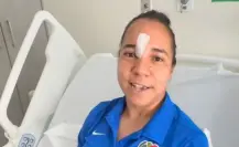 Charlyn Corral es operada tras la patada en la cara frente al Barcelona, ¿qué tan grave es su lesión?