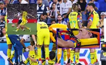 VIDEO | ¡Escalofriante! Dagoberto Espinoza sale con lesión de gravedad ante Rayados